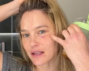 "מצאתי את הדבר הזה, שהוא ממש קסם": בר רפאלי הדליקה אותנו על מוצר הפלאים