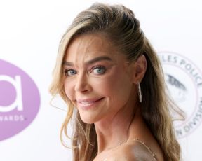 דניס ריצ'רדס כבר לא נראית אותו דבר: "רציתי להחזיר דברים למעלה"